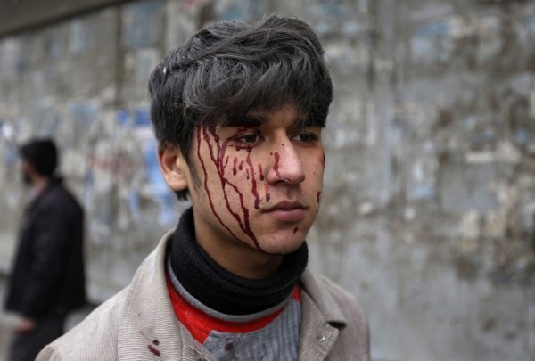 Раненный афганский мальчик с окровавленным лицом, на месте, где взорвалась машина во время атаки в Кабуле, 16 января 2013 года. Бомба разорвалась в машине напротив ворот афганских спецслужб, рядом с тщательно забаррикадированными правительственными зданиями и посольствами Западных стран. (Рейтер / Омар Собани)
