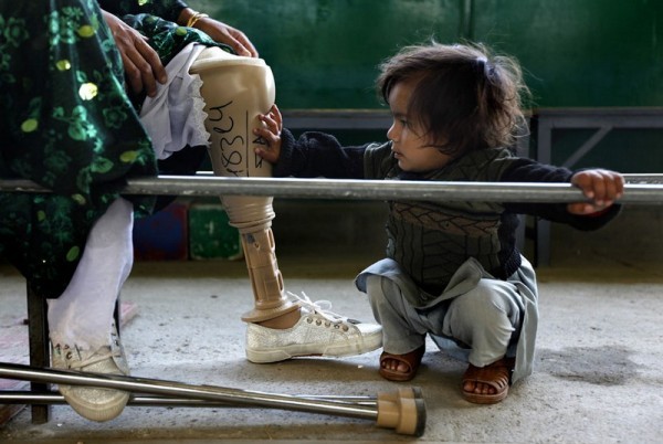 44.Афганская девочка трогает искусственную ногу своей матери в ортопедическом центре ICRC Али Абад в Кабуле, 12 ноября 2009 года. Центр, которым управляют в основном люди с ограниченными возможностями, помогает с обучением и реабилитацией жертвам  минных разрывов, а также людям с разными дефектами. В центре им помогают эффективно влиться в общество. (Рейтер / Джерри Лампен)