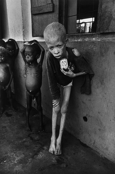 Дон МакКуллин. Мальчик-альбинос, Биафра. 1969. «Это одна из моих самых непристойных фотографий», – Дон МакКуллин. 