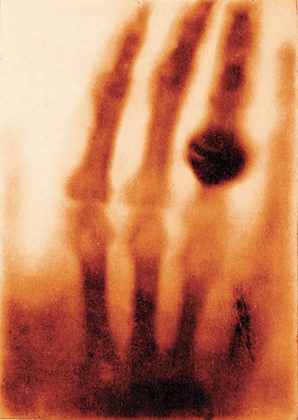 Вильгельм Рентген. Рука миссис Рентген. 1895. «Я не размышляю; я исследую», – Вильгельм Рентген.
