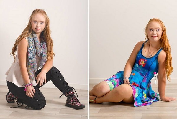 Дети российских артистов с синдромом дауна